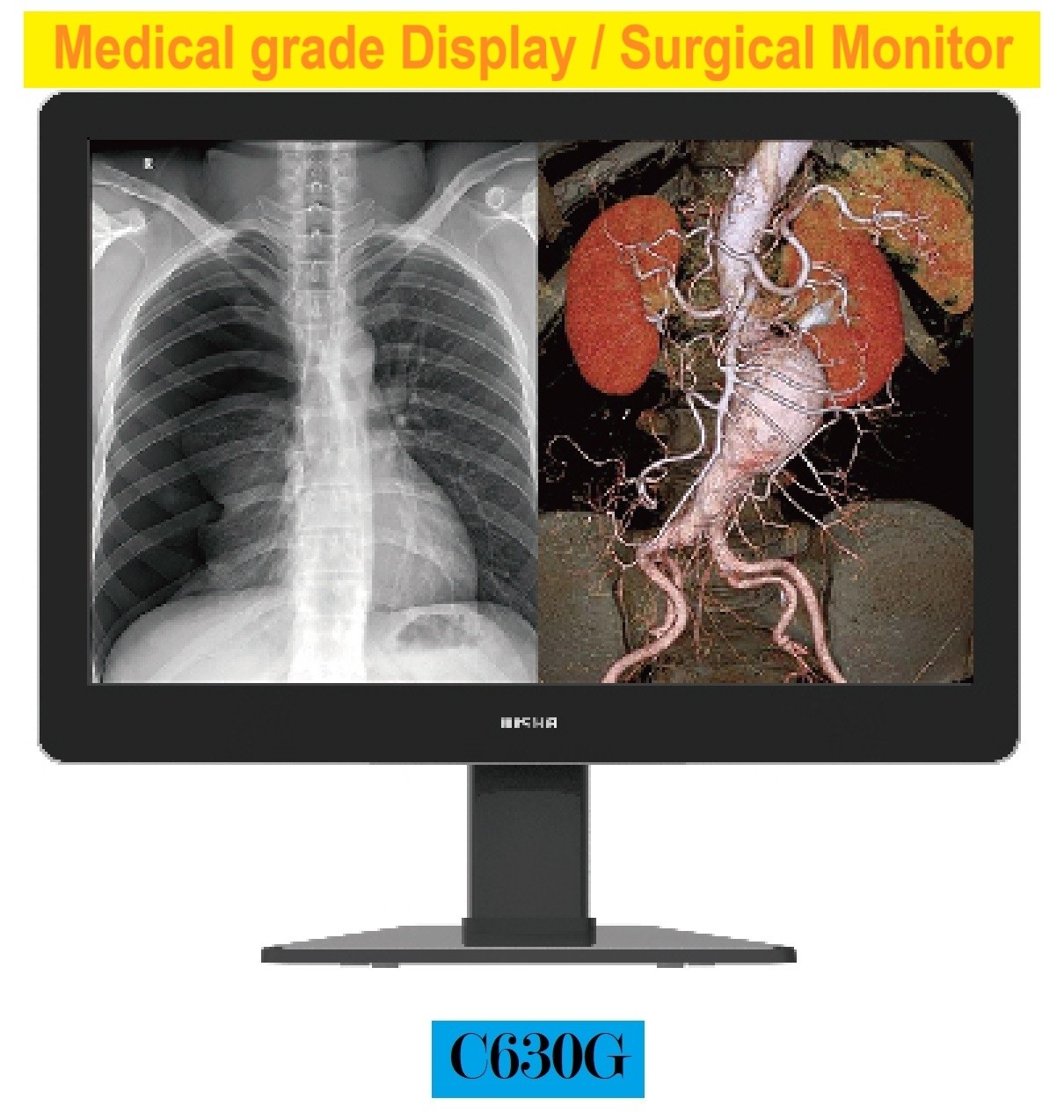 Medical Display
