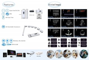 Handheld Ultrasound