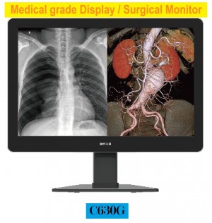 Medical Display