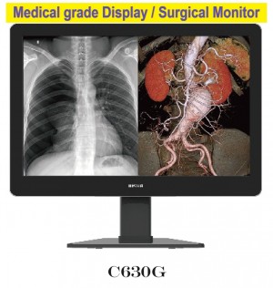 Medical Display